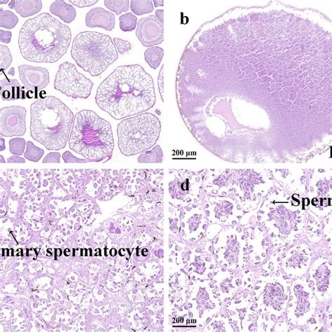 Differential Expression Of Sex Related Genes In Malefemale Gonads From