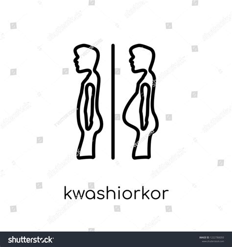 Kwashiorkor Icon Trendy Modern Flat Linear Stock Vector (Royalty Free ...