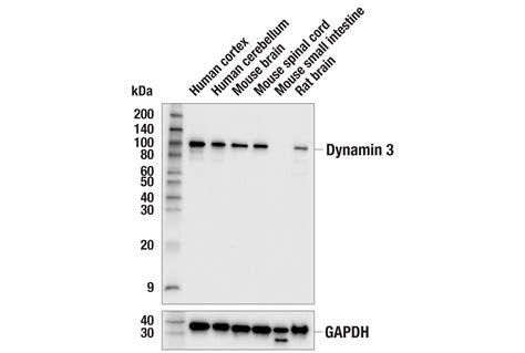 Dynamin 3 E5R5E Rabbit MAb Cell Signaling Technology