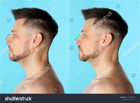 Most Beautiful Nose Shape Men