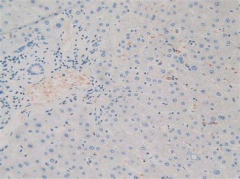 Sirp Alpha Polyclonal Antibody Invitrogen L Unconjugated