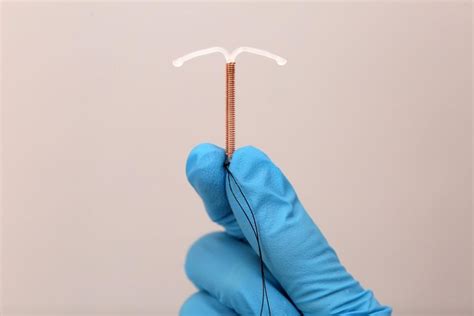 How To Make Your IUD Procedure More Comfortable Monique Petteys FNP C