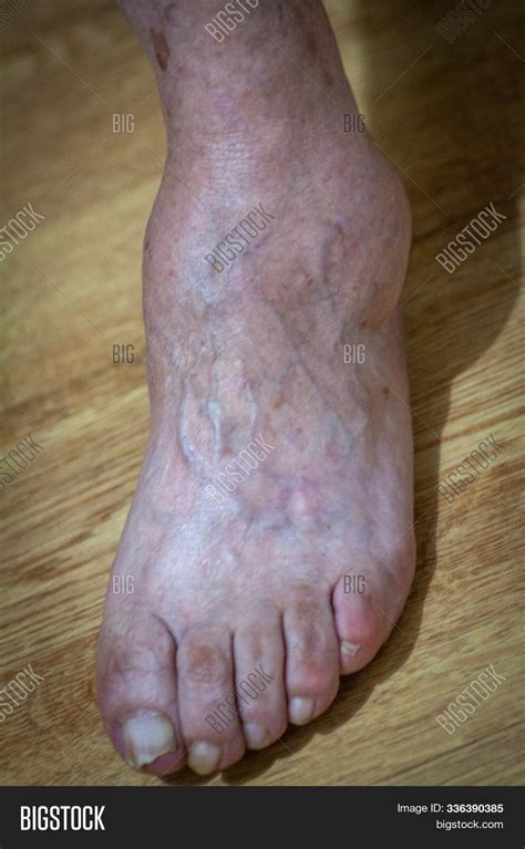 Closeup Feet Old Man Image And Photo Free Trial Bigstock