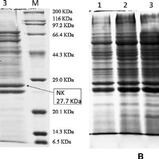 Sds Page Analysis Of The Extracellular Proteins Of Wx Pp Snt And