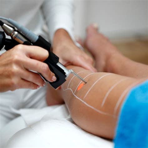 Epilation laser jambe aisselle maillot test et avis à Rennes