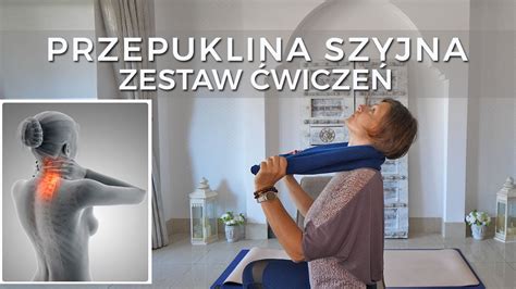 Przepuklina Szyjna Zestaw Wicze Youtube