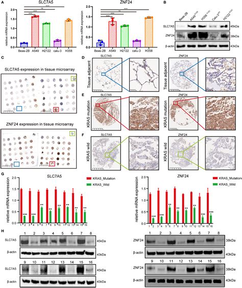 Frontiers ZNF24 Regulates The Progression Of KRAS Mutant Lung