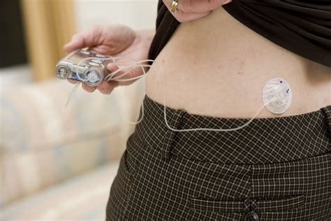 Insulin Pumps Better Than Injections For Type 2 Diabetes Gponline