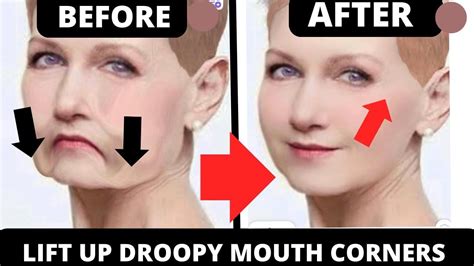 How To Lift Up Droopy Mouth Corners Face Yoga For Droopy Mouth