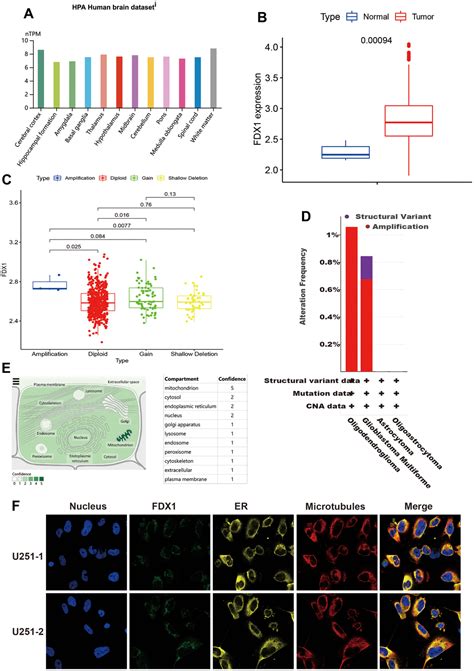 FDX1 Serves As A Prognostic Biomarker And Promotes Glioma Progression