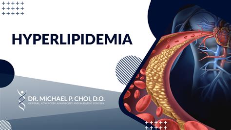 Everything You Should Know About Hyperlipidemia