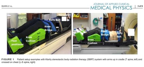 Klarity Sbrt System Is A Promising Alternative To The Bodyfix System