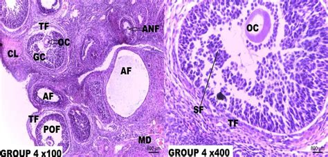 Photomicrograph Of The Rat Ovary Tissue Section Of Group H E