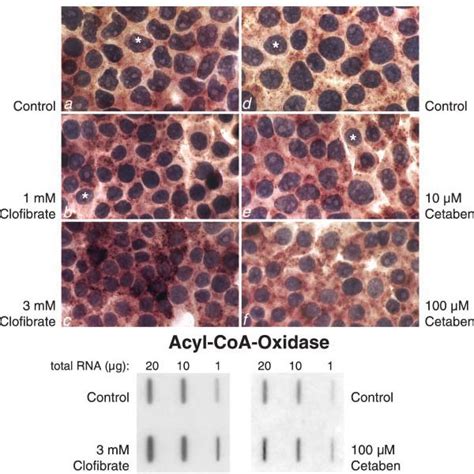 RNA In Situ Hybridization Protocol Using Digoxigenin Labeled CRNA