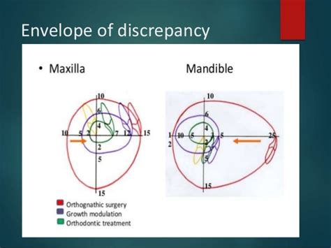 Major surgical procedures