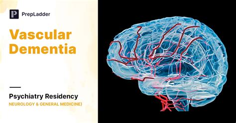 Vascular Dementia Causes Diagnosis Treatment