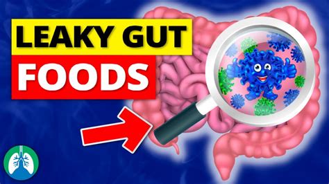 Top 10 Foods That Can Cause A Leaky Gut Must Avoid Youtube