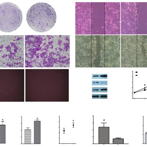 Effects Of Galectin Overexpression On Pcc Cells A G The Colony