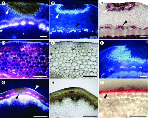 Patterns Of Damage And Lignification In Transverse Sections Of Brassica Download Scientific