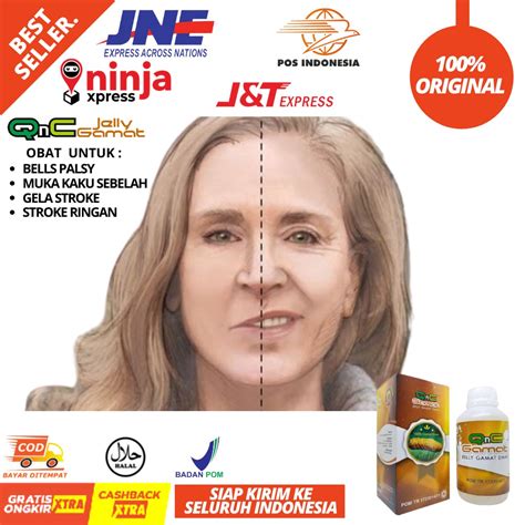 Jual Obat Bells Palsy Bibir Miring Mulut Mencong Wajah Kaku Sebelah