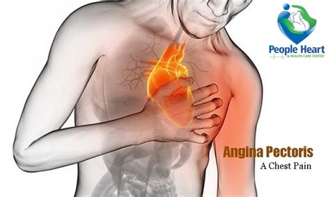 What is Angina | Symptoms and Types of Angina | Prevention?