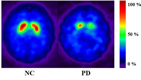 Neuroimaging Techniques And What A Brain Image Can Tell Us Technology