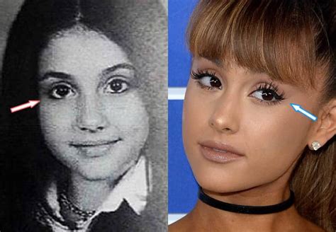 Did Ariana Grande Have Plastic Surgery? (Before & After 2021)