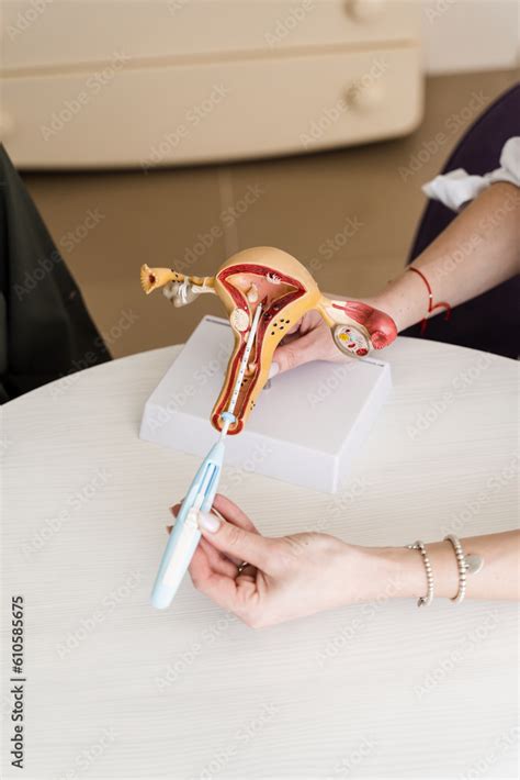 Close Up Insert Of Intrauterine Device Iud Into Your Uterus Model Iud