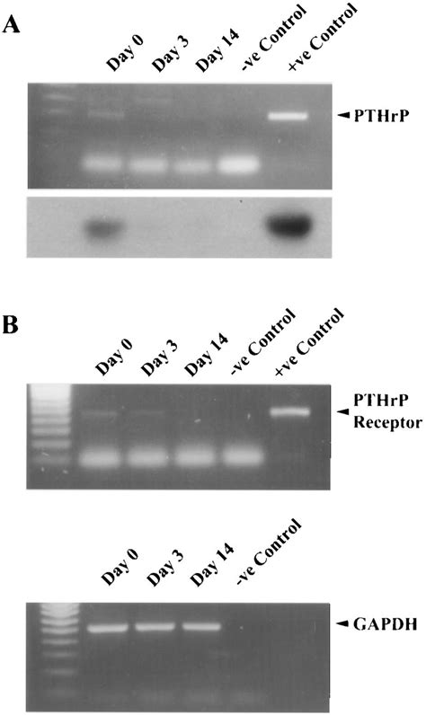 PTHrP And PTH PTHrP Receptor Expression In 3T3 L1 Preadipocytes RNA