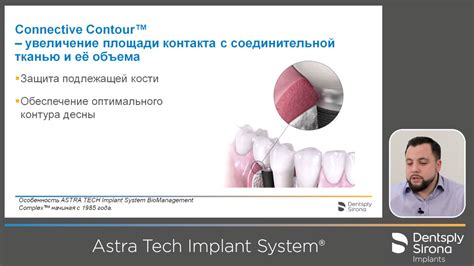 Astra Tech Implant System Видео лекция по хирургии Youtube