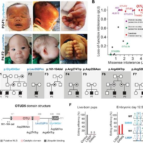 Clinical Table Highlighting Multiple Congenital Anomalies In Patients