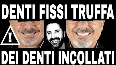 Denti Fissi Truffa Dei Denti Incollati YouTube