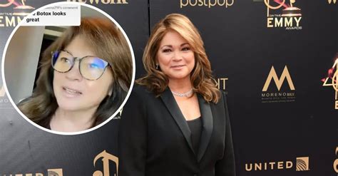 Valerie Bertinelli Shares How Botox Changed Her Face In Response To