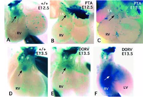 Cardiac Neural Crest Cells Populate The Outflow Tract Of Wild Type And