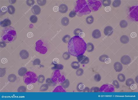 Segmented Neutrophil Cell In Human Blood Smear Stock Image