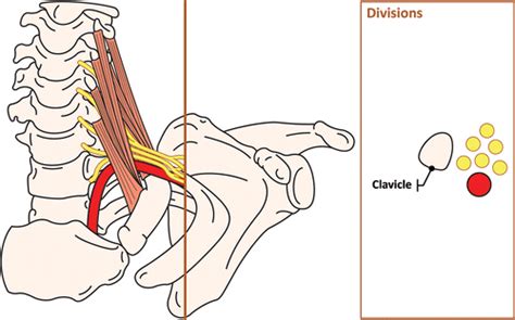 Brachial Plexus Mri