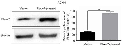 Upregulation Of Fbxw7 Decreases The Migration And Invasion Of Achn Download Scientific Diagram