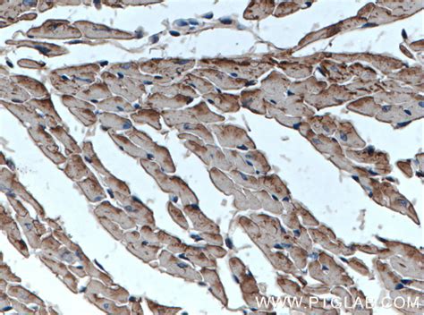 Cardiac Troponin T Antibody 15513 1 AP Proteintech