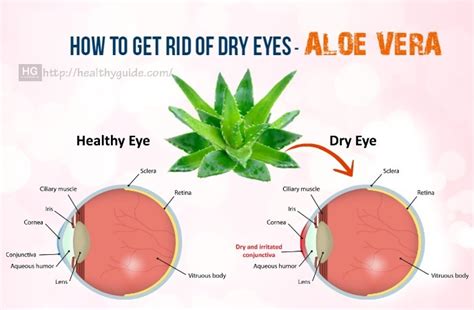 18 Tips How To Get Rid Of Dry Eyes In The Morning Fast And Naturally