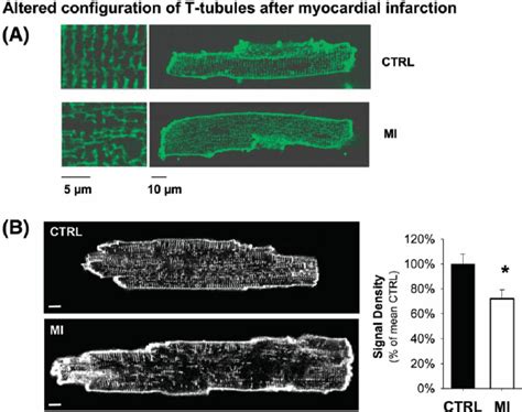 Alterations in T-tubules after myocardial infarction. ( A ) Examples of... | Download Scientific ...