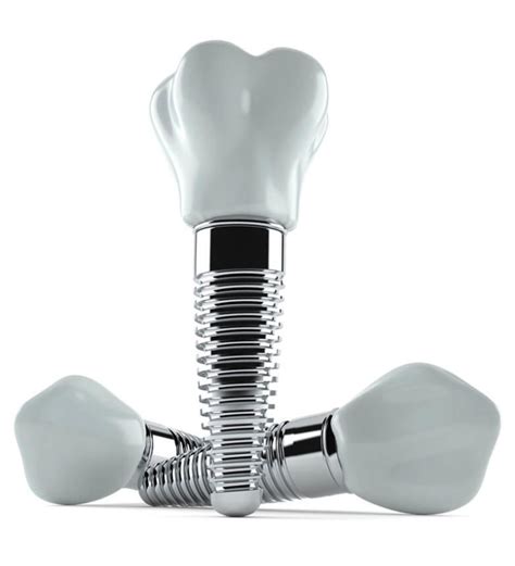 Dental Implants North Hollywood Victory Plaza Dental Group