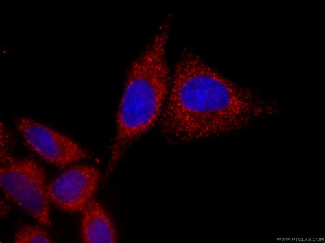 Nf κb P65 Antibody Cl594 66535 Proteintech 武汉三鹰生物技术有限公司