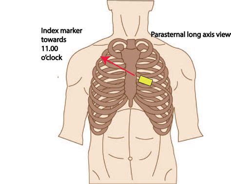 Discovering The Aorta Through Ultrasound Critical Care Sonography