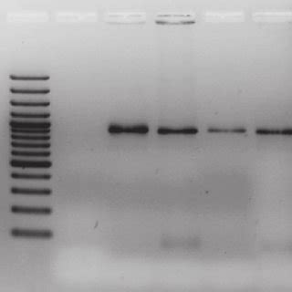 9 9 9 9 Ethidium Bromide Stained Agarose Gel Electrophoresis Of The 890