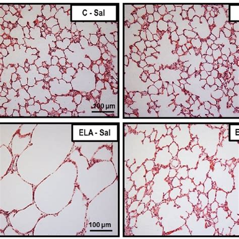 Representative Photomicrographs Of Lung Parenchyma Stained With