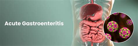 Know About Acute Gastroenteritis:Causes and Preventative Measures