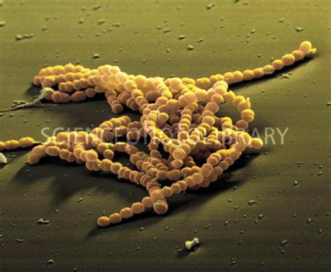 Streptococcus Agalactiae Bacteria Coloured Sem Streptococcus