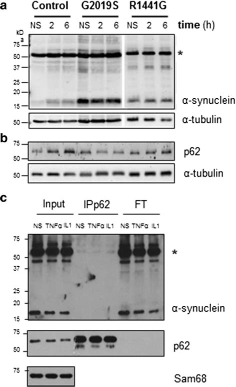 Effect of TNFα on α synuclein a Western blot analysis showing