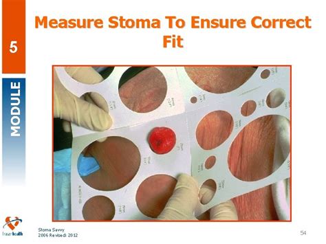 Stoma Measuring Guide Printable Guides Online