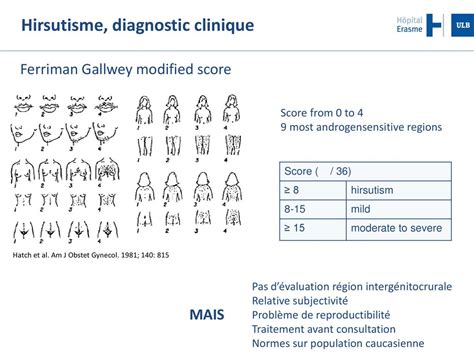 Natacha Driessens Service Dendocrinologie De Lh Pital Erasme Ulb